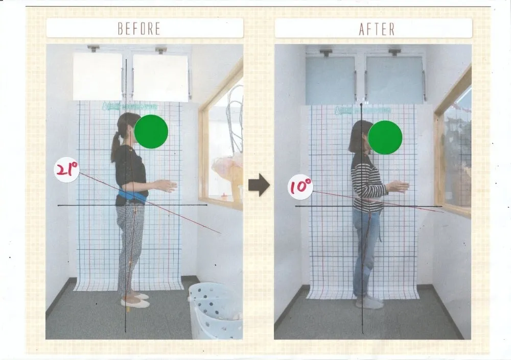 骨盤矯正・ビフォーアフター